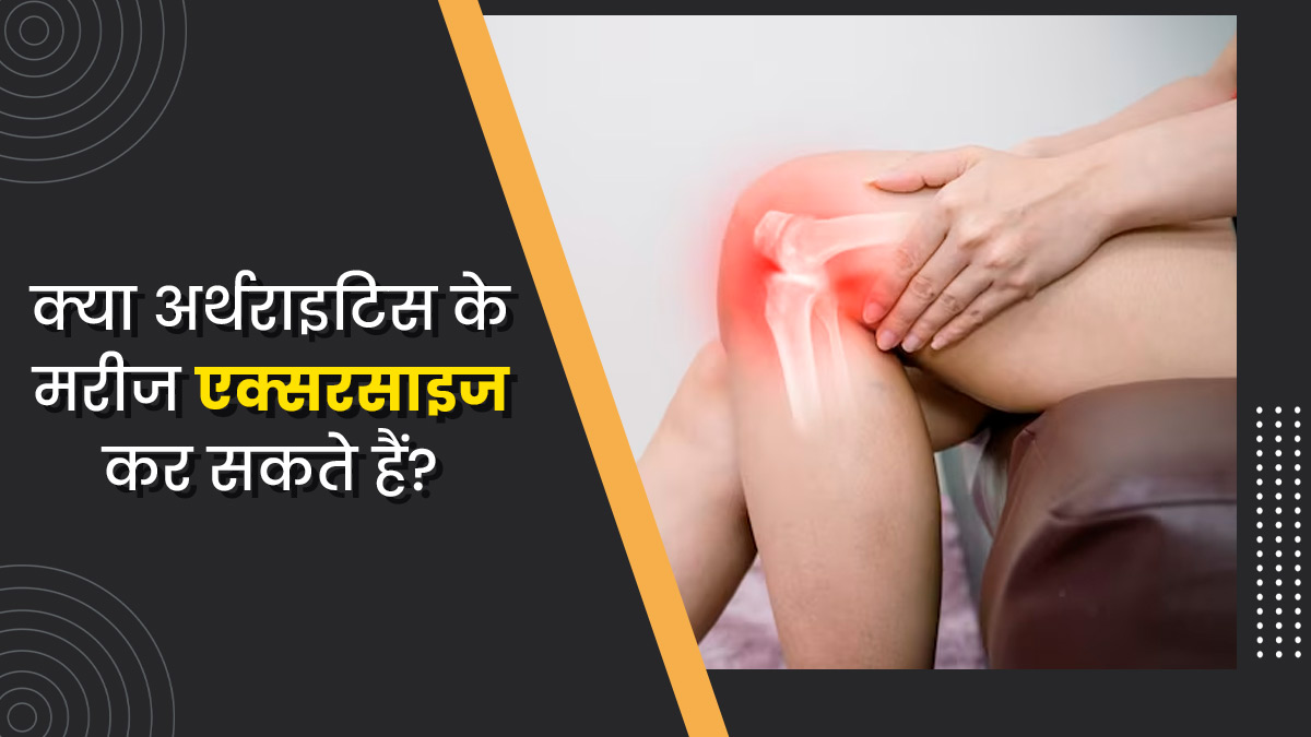 क्या गठिया के मरीज एक्सरसाइज कर सकते हैं? जानें क्या कहते हैं डॉक्टर