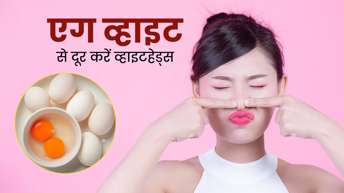 व्हाइटहेड्स मिटाने में मदद करेगा अंडे का सफेद हिस्सा (एग व्हाइट), जानें इस्तेमाल का तरीका