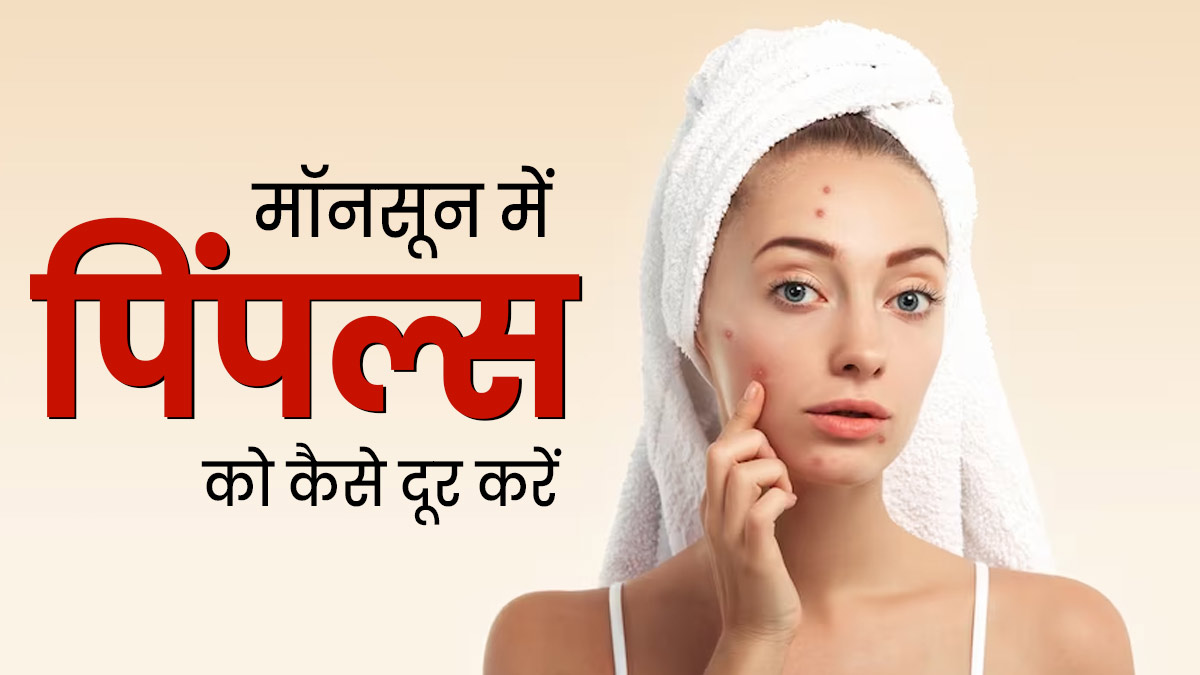 मॉनसून में पिंपल्स से रहते हैं परेशान, तो दूर करने के लिए लगाएं ये 3 फेस मास्क