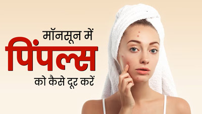 मॉनसून में पिंपल्स से रहते हैं परेशान, तो दूर करने के लिए लगाएं ये 3 फेस मास्क