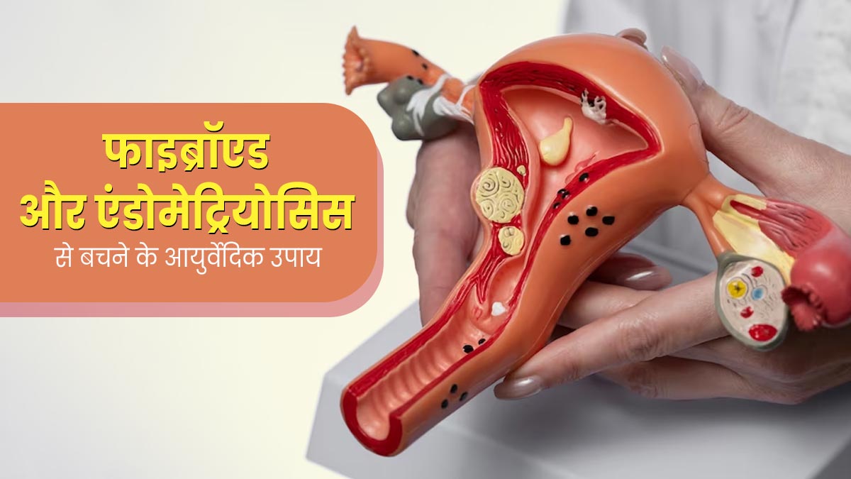 फाइब्रॉएड और एंडोमेट्रियोसिस बचने के लिए महिलाएं फॉलो करें ये 5 आयुर्वेदिक टिप्स