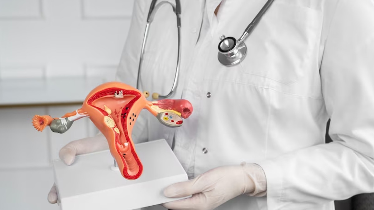 Ovarian-Cystectomy 