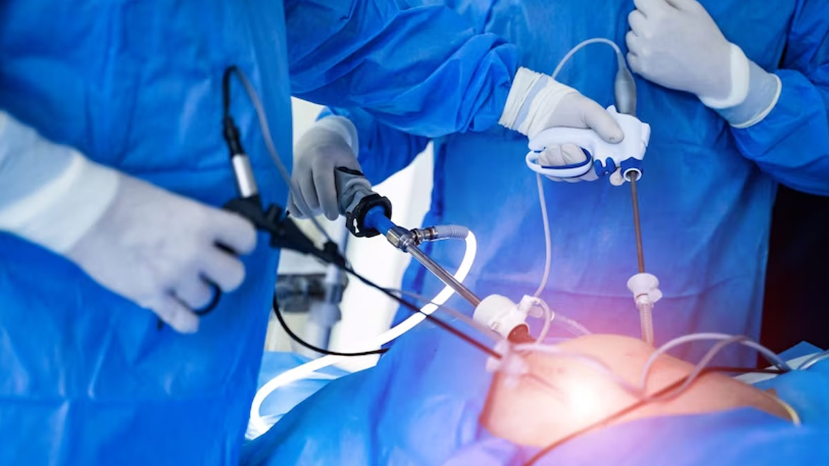 laparoscopic-surgery