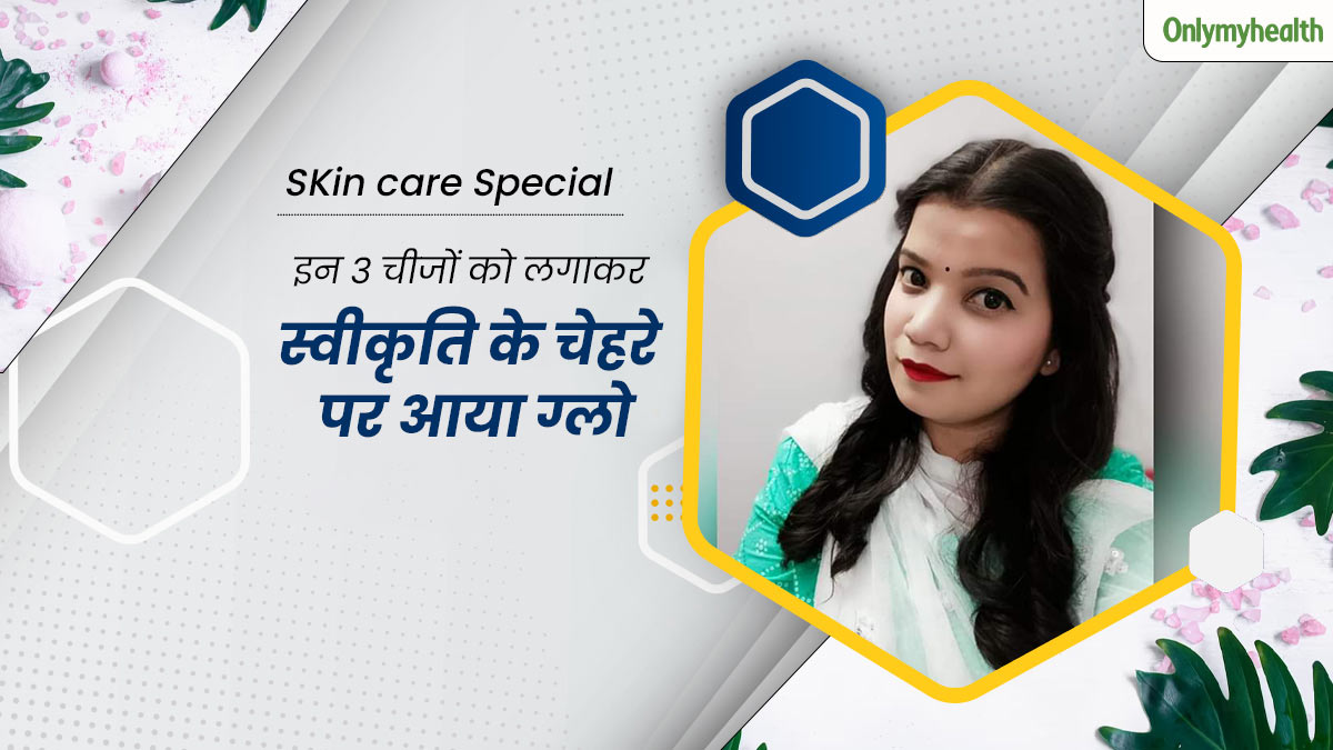 चेहरे के मुंहासों और दाग-धब्बों को मिटाने के लिए स्वीकृति लगाती हैं ये 3 चीजें, बना रहता है निखार 