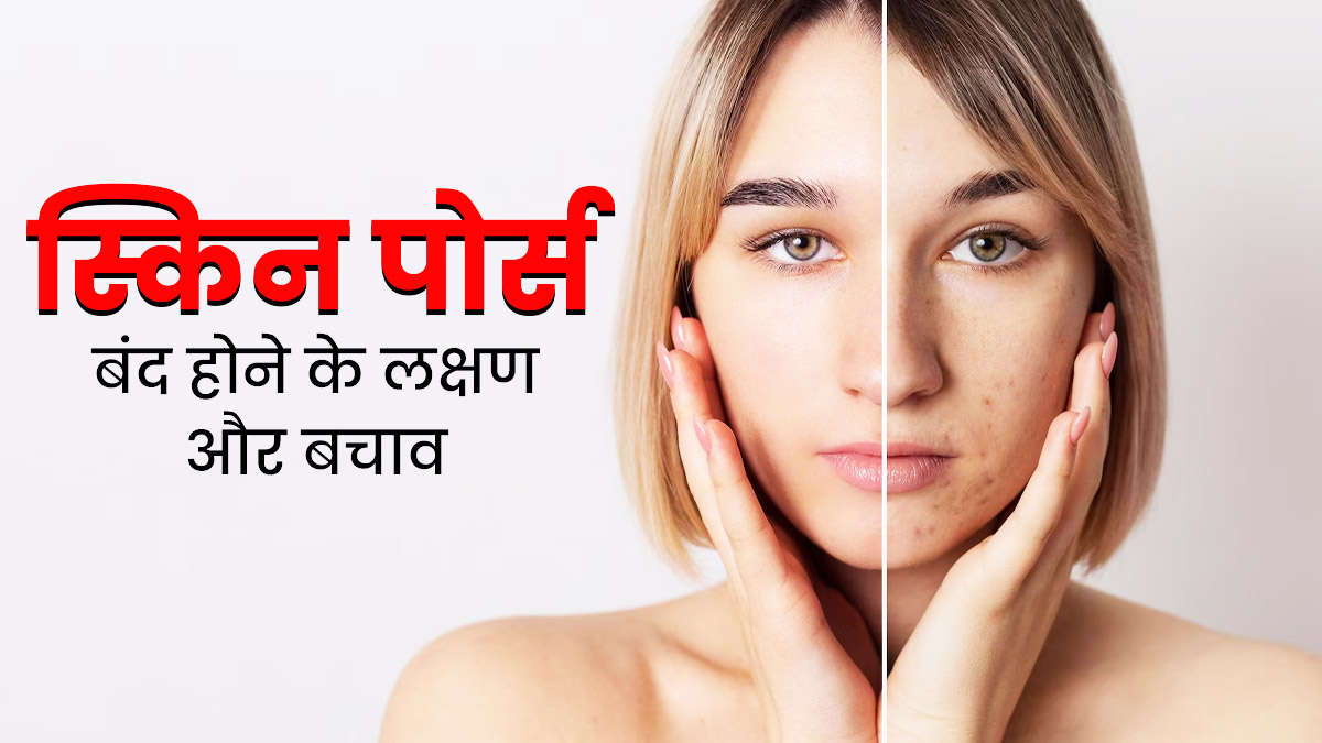 स्किन पोर्स बंद होने पर नजर आते हैं ये 4 लक्षण, जानें इससे बचने का तरीका
