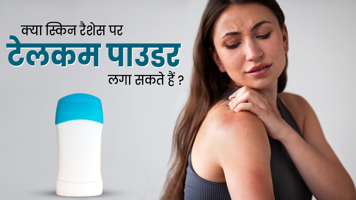 क्या स्किन रैशेज पर टेलकम पाउडर लगाना नुकसानदायक होता है? जानें एक्सपर्ट की राय