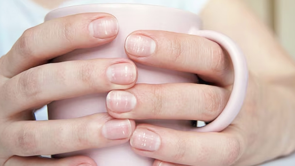 Spotted white fingernails | MDedge Family Medicine