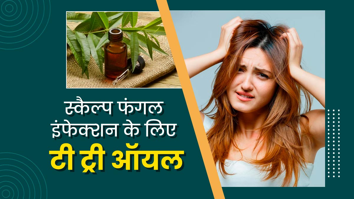 स्कैल्प में फंगल इंफेक्शन होने पर इन 4 तरीकों से करें टी ट्री ऑयल का इस्तेमाल, दूर होगी खुजली और जलन