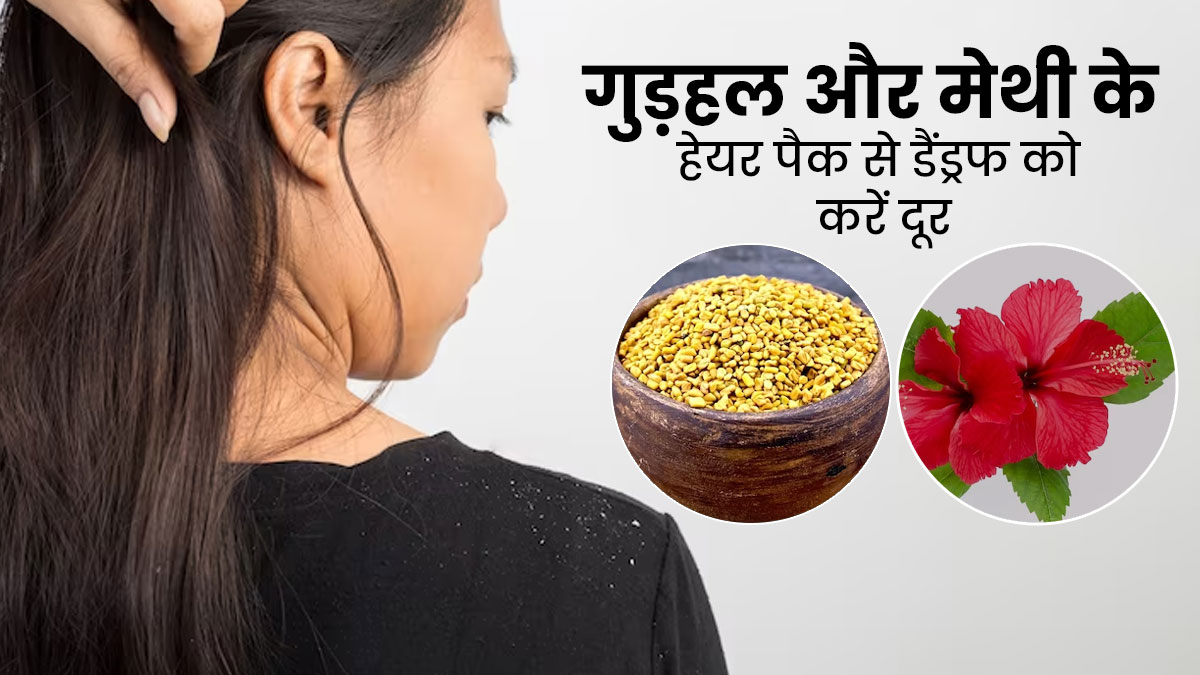 डैंड्रफ से छुटकारा दिलाएगा गुड़हल और मेथी से बना हेयर पैक, जानें बनाने और लगाने का तरीका