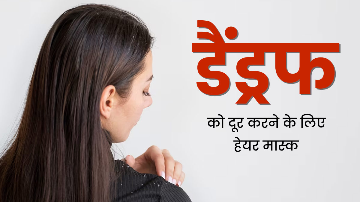 डैंड्रफ से छुटकारा पाने के लिए लगाएं 3 हेयर मास्क, दूर होगी खुजली की समस्या