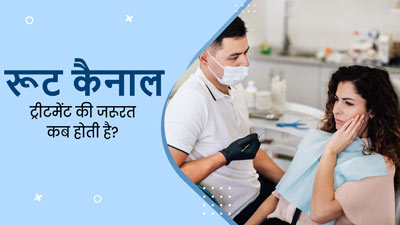 दांत के ल‍िए रूट कैनाल ट्रीटमेंट की जरूरत कब पड़ती है? डॉक्‍टर से जानें 