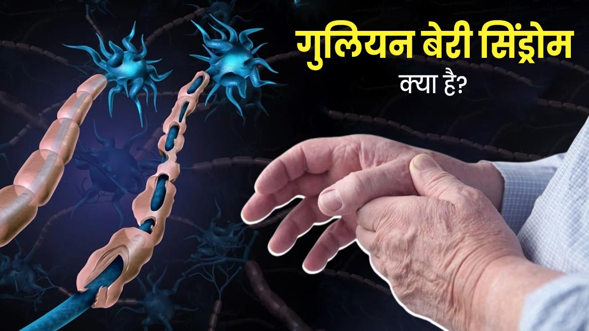 गुलियन बेरी सिंड्रोम के कारण लोग हो रहे पैरालाइज, पेरू में लगी हेल्थ इमरजेंसी, जानें क्या है यह बीमारी   