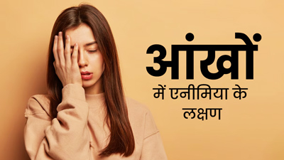 आंखों में दिखें ये 5 लक्षण, तो समझ जाएं एनीमिया का शिकार हो रहे हैं आप 