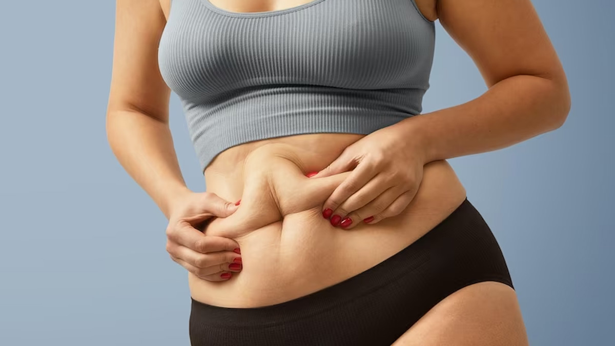 arthritis can cause obesity