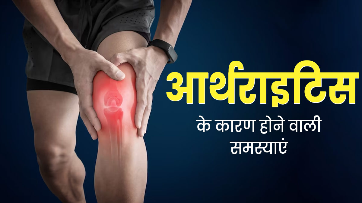 अर्थराइटिस की वजह से शरीर में हो सकती हैं ये 5 समस्याएं, जरूर बरतें सावधानी