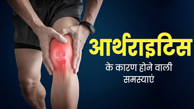 अर्थराइटिस की वजह से शरीर में हो सकती हैं ये 5 समस्याएं, जरूर बरतें सावधानी