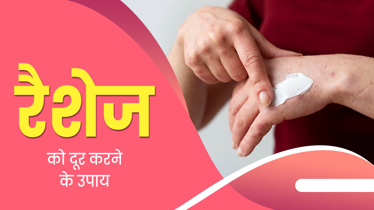 मॉनसून में स्किन रैश से हैं परेशान? दूर करने के लिए अपनाएं ये 5 उपाय 
