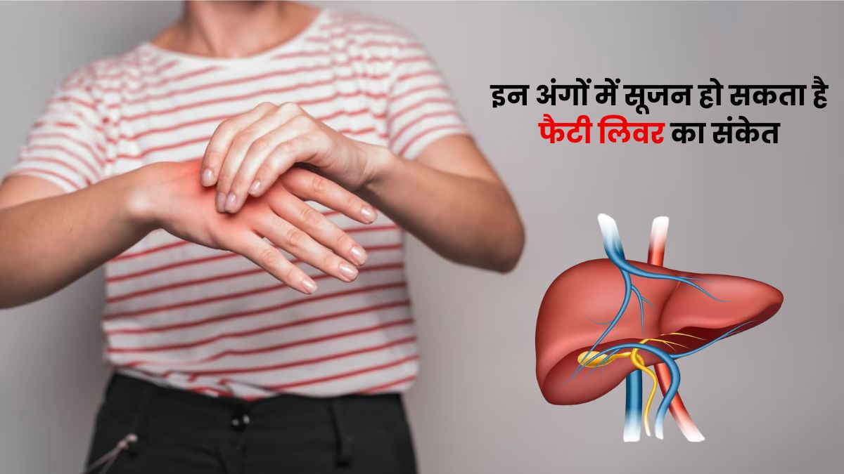 शरीर के इन अंगों में सूजन हो सकता है फैटी लिवर का संकेत, जानें बचाव के उपाय