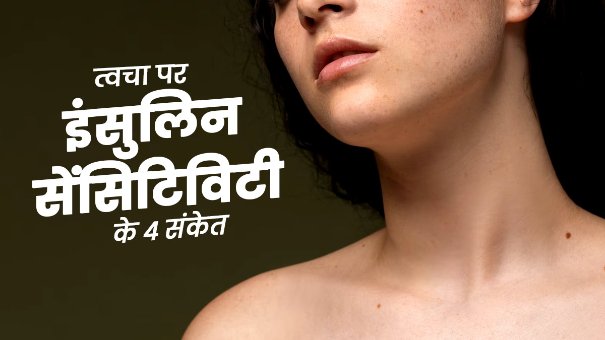 त्वचा पर दिखने वाले ये 4 लक्षण भी हो सकते हैं इंसुलिन रेजिस्टेंस का संकेत, जानें इसे बेहतर बनाने के उपाय