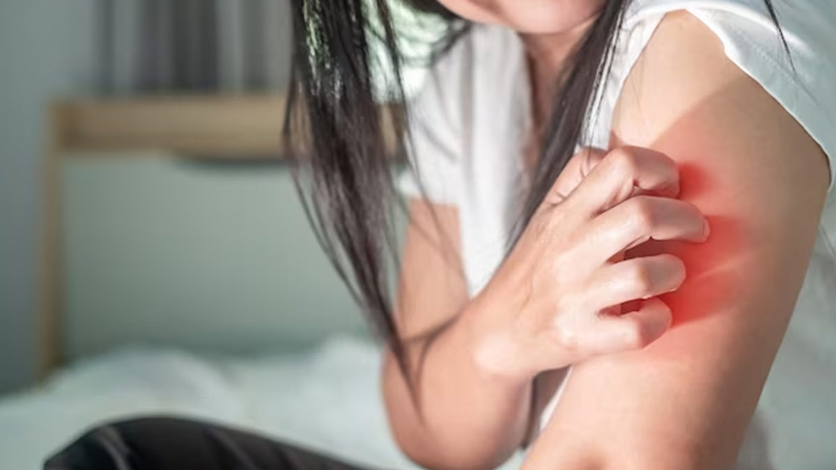 Dengue Malaria And Chikungunya