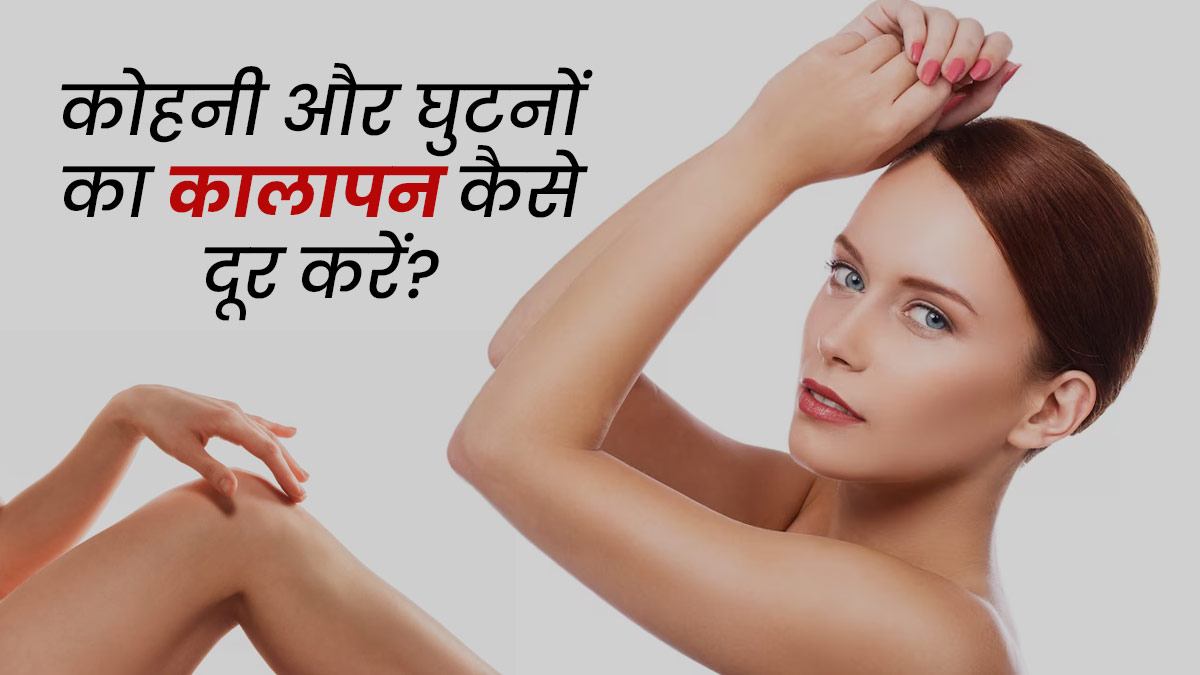 कोहनी और घुटनों का कालापन दूर करने के लिए इन 4 तरीकों से लगाएं नारियल तेल, साफ हो जाएगी स्किन