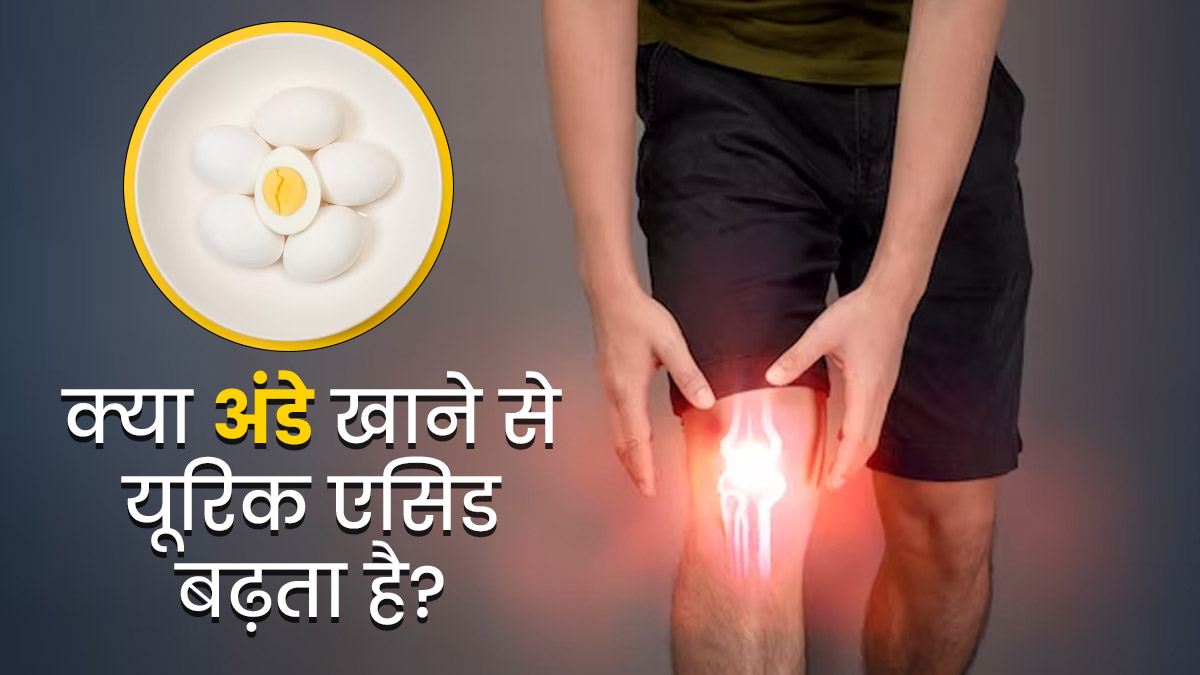 क्या अंडे खाने से यूरिक एसिड बढ़ता है? एक्सपर्ट से जानें गठिया के रोगियों को अंडे खाने चाहिए या नहीं