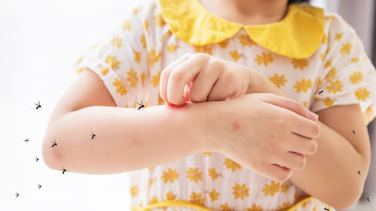  Dengue Fever in Kids