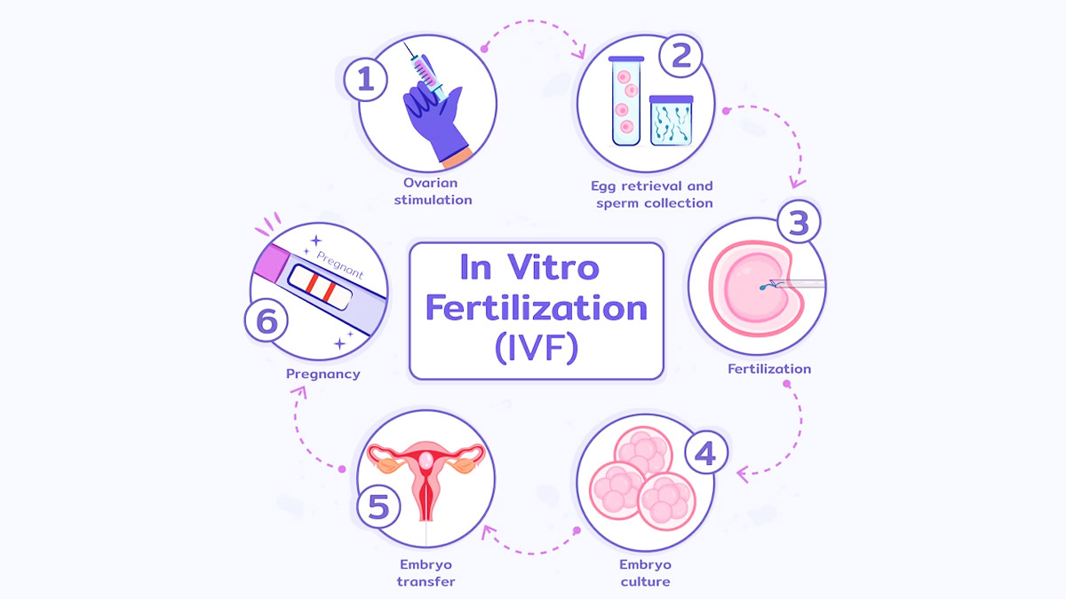 IVF stages