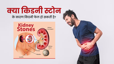 क्या पथरी होने की वजह से किडनी फेल हो सकती है? डॉक्टर से जानें 