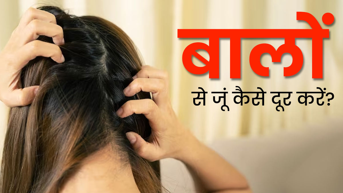 मानसून में सिर में पड़ गए हैं जूं, तो दूर भगाने के लिए अपनाएं ये 5 घरेलू उपाय