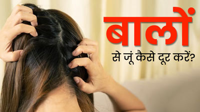 मानसून में सिर में पड़ गए हैं जूं, तो दूर भगाने के लिए अपनाएं ये 5 घरेलू उपाय