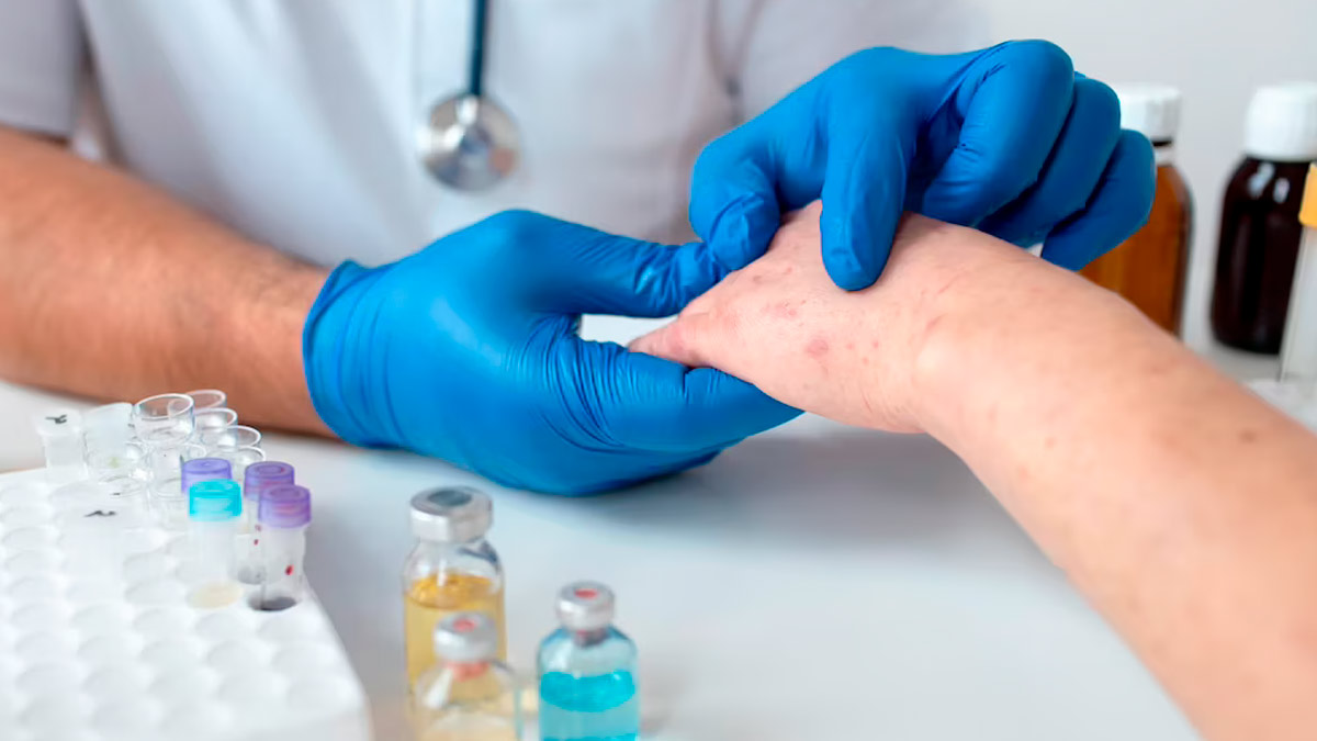 Diabetes Can Lead To Skin Problems: Common Conditions To Watch Out For