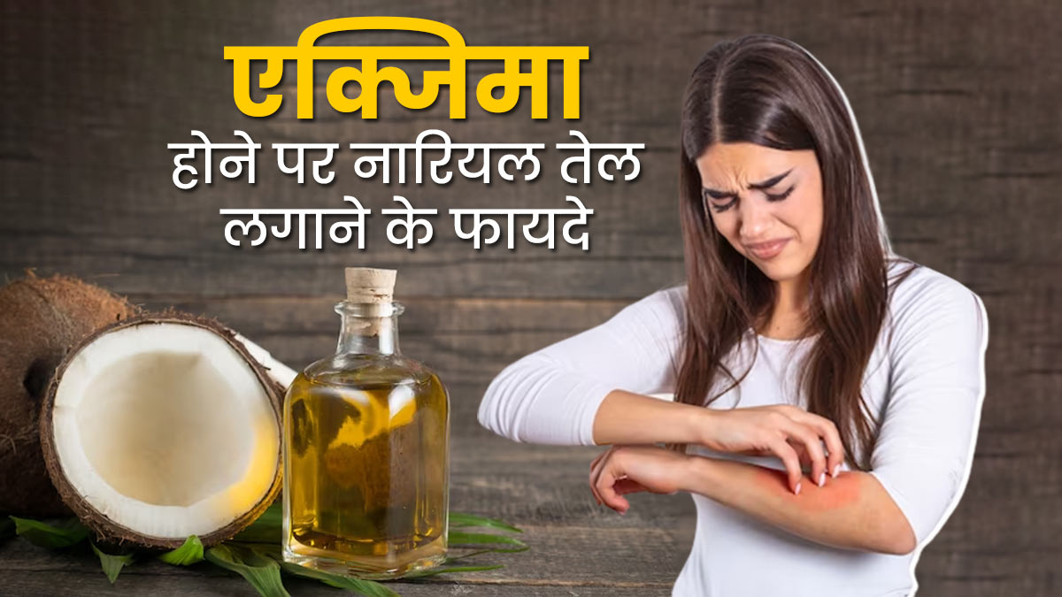 एक्जिमा के लक्षणों को कम करने में मदद करेगा नारियल तेल, इस तरह से करें इस्तेमाल