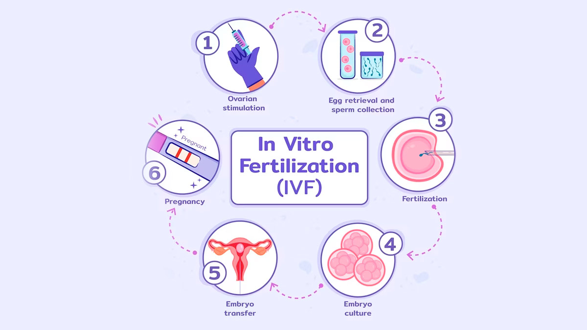 what not to do during ivf treatment