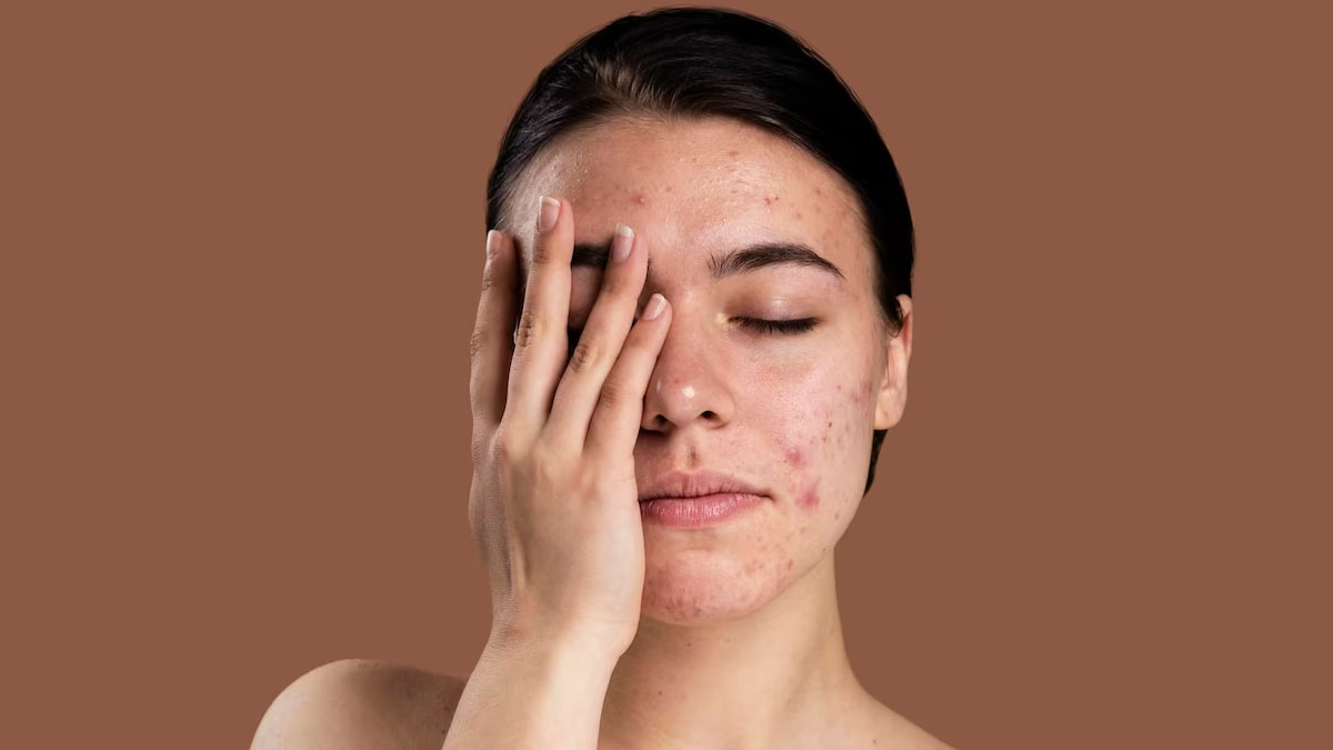 open pores skin care