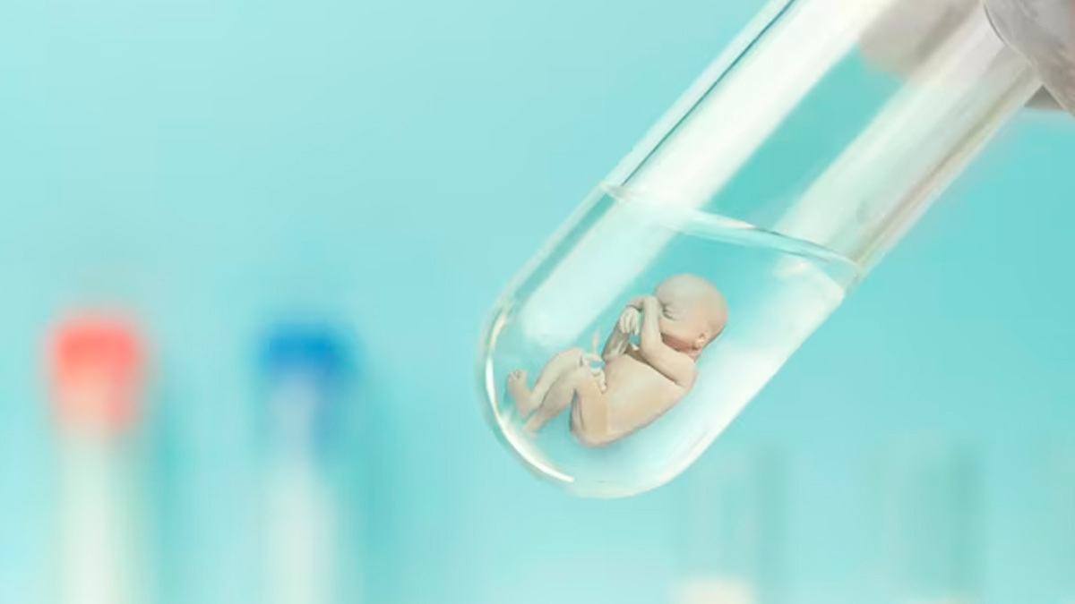IVF