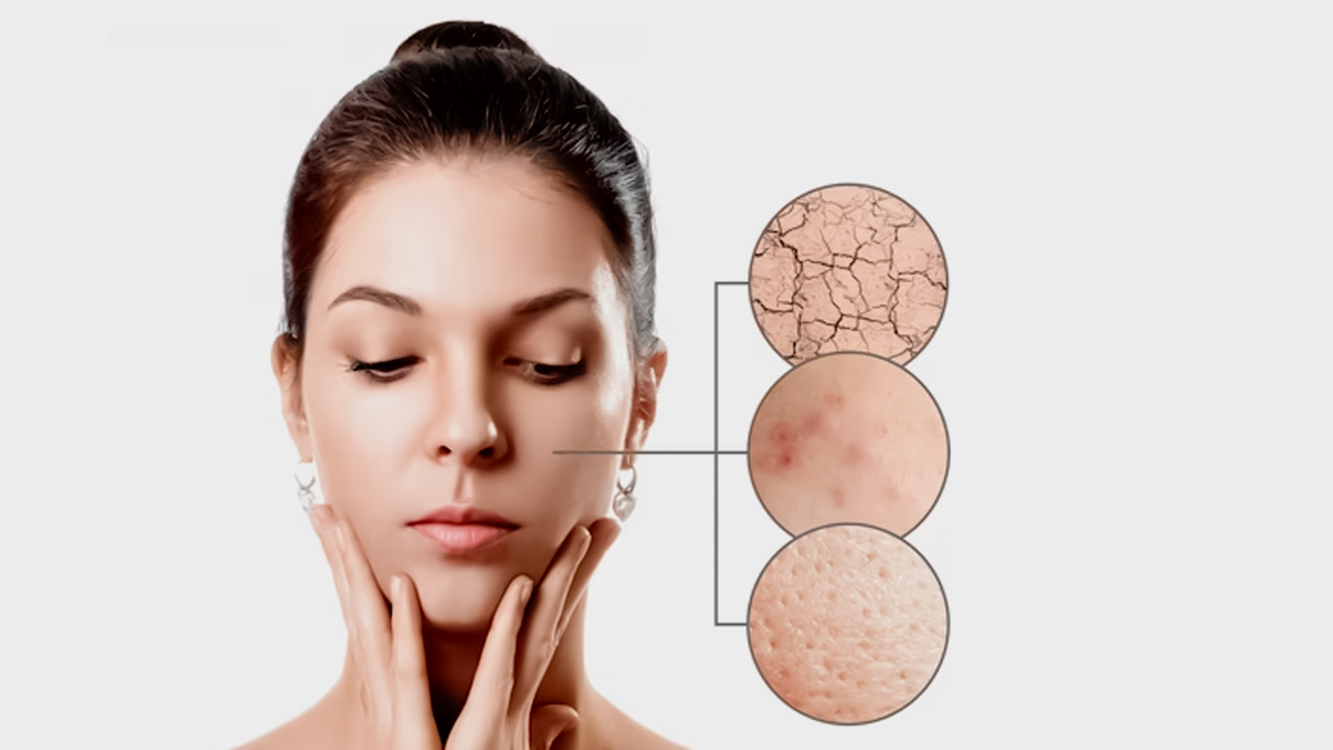 how to use jojoba oil for eczema