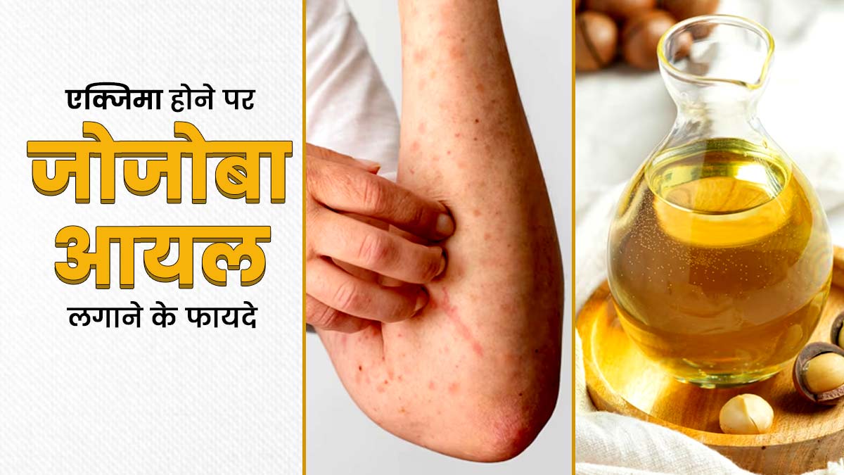 क्या एक्जिमा के लक्षणों को कम करने में मददगार है जोजोबा ऑयल? जानें एक्सपर्ट की राय