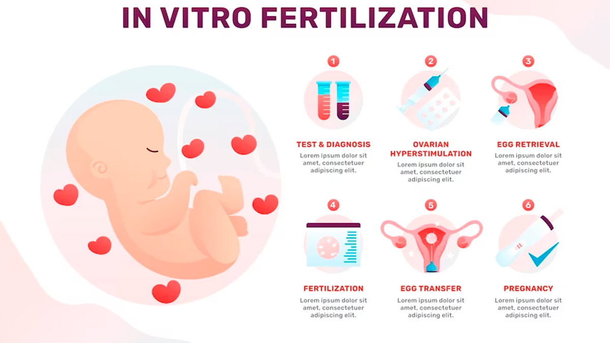 ivf risk