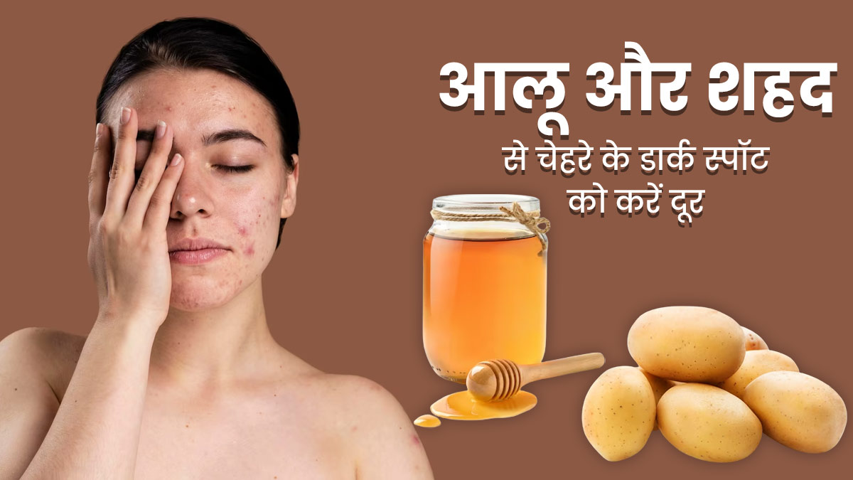 चेहरे के डार्क स्पॉट्स हटाने में मदद करेगा आलू और शहद का पेस्ट, जानें इस्तेमाल का तरीका 
