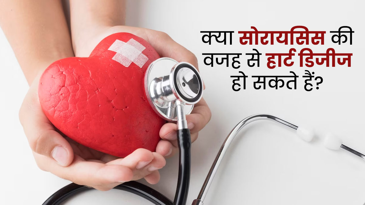 क्या सोरायसिस की वजह से हृदय रोग हो सकते हैं? जानें इन दोनों में संबंध 