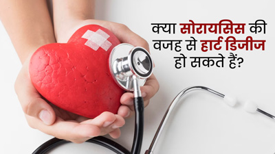 क्या सोरायसिस की वजह से हृदय रोग हो सकते हैं? जानें इन दोनों में संबंध 