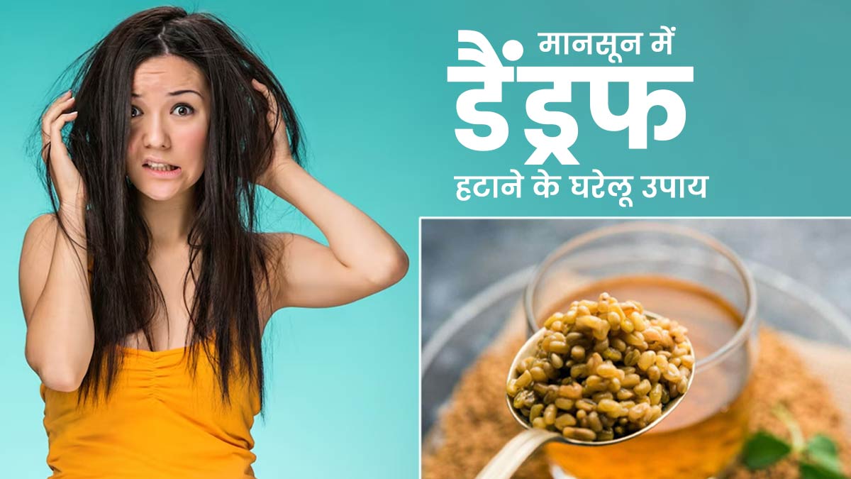 मानसून में डैंड्रफ से छुटकारा पाने के लिए आजमाएं ये 5 घरेलू उपाय, स्कैल्प की खुजली भी होगी दूर