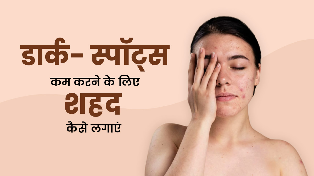 चेहरे के दाग-धब्बों को हटाने के लिए लगाएं शहद के 4 फेस मास्क, स्किन बनेगी बेदाग 