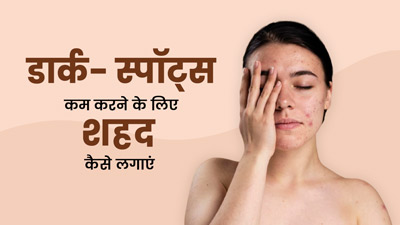 चेहरे के दाग-धब्बों को हटाने के लिए लगाएं शहद के 4 फेस मास्क, स्किन बनेगी बेदाग 