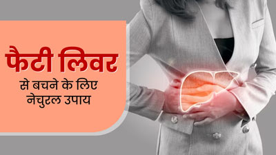 फैटी लिवर की समस्या से बचने के लिए अपनाएं ये 5 नेचुरल उपाय, लिवर रहेगा स्वस्थ