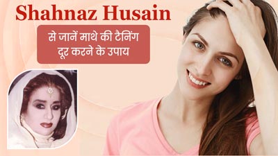माथे की टैनिंग हटाने करने के लिए अपनाएं Shahnaz Husain के बताए ये 5 घरेलू उपाय