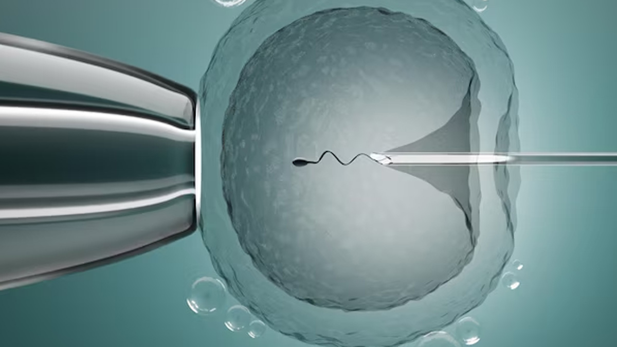 IVF process 