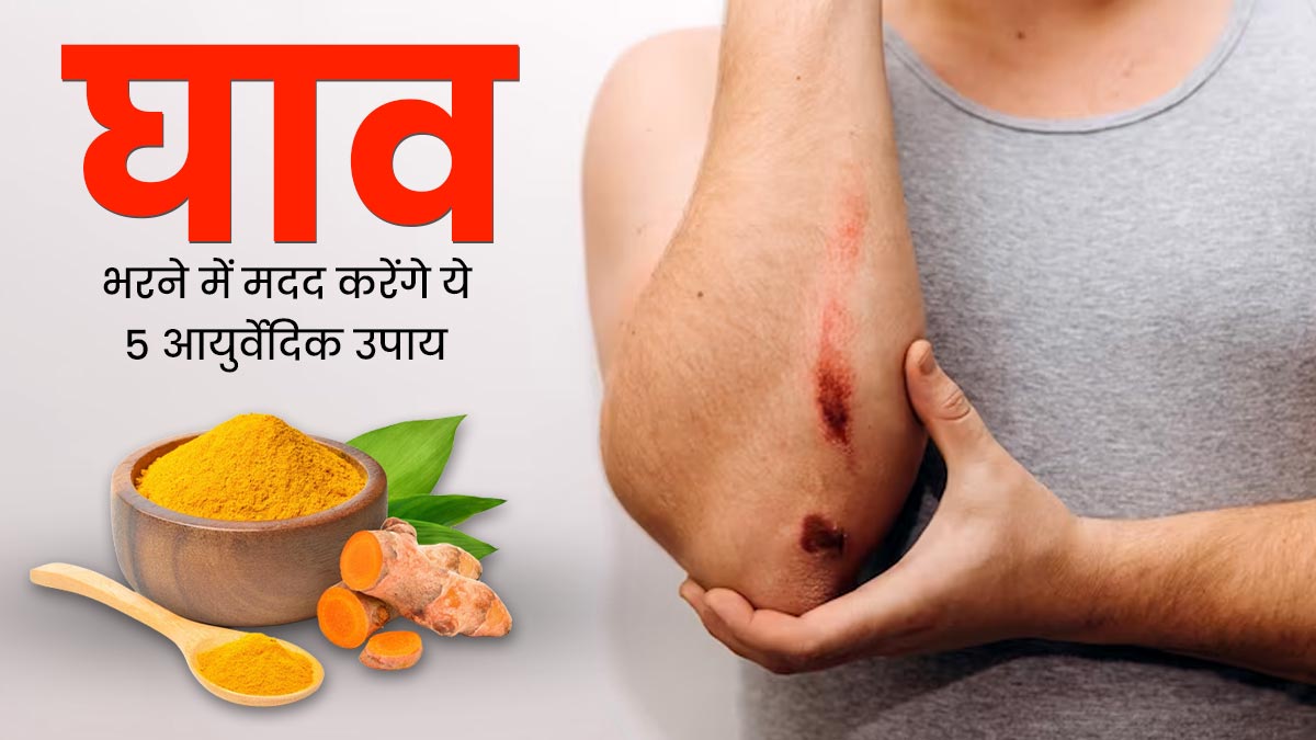 चोट लगने या कटने-छिलने पर आजमाएं ये 5 आयुर्वेदिक उपाय, जल्दी घाव भरने में मिलेगी मदद