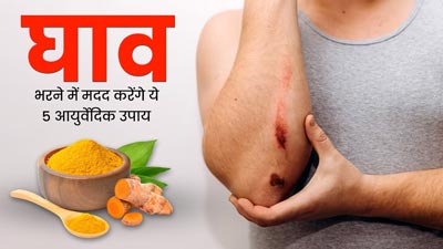 चोट लगने या कटने-छिलने पर आजमाएं ये 5 आयुर्वेदिक उपाय, जल्दी घाव भरने में मिलेगी मदद